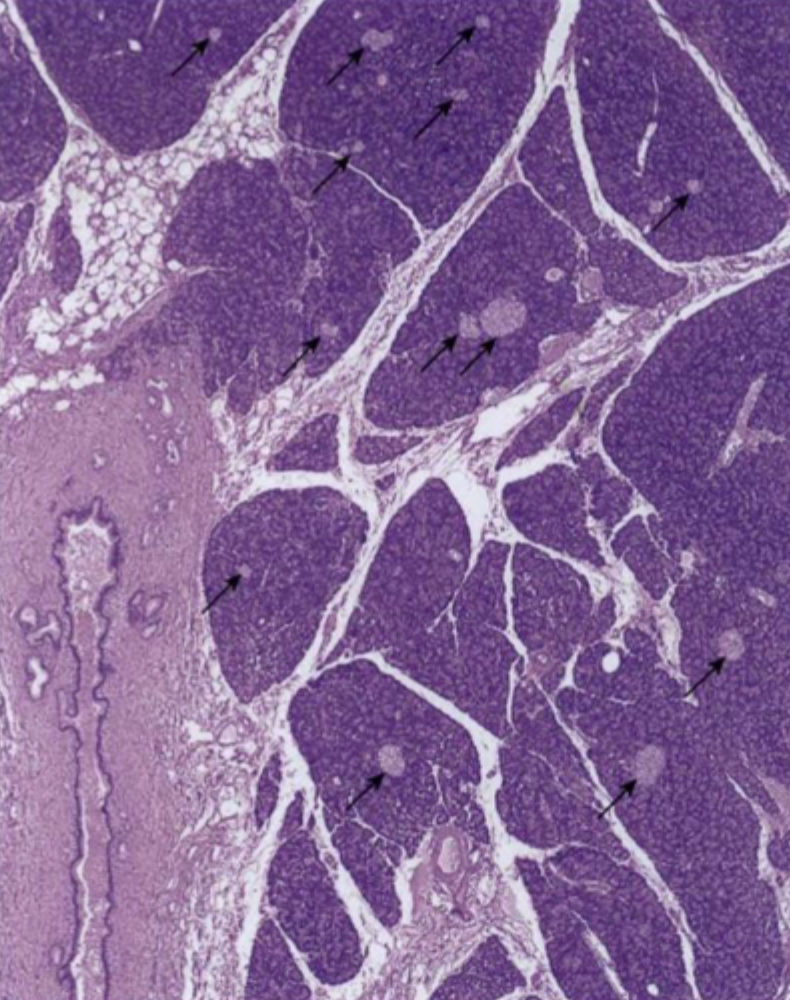 <p>Mangler zymogengranula</p>