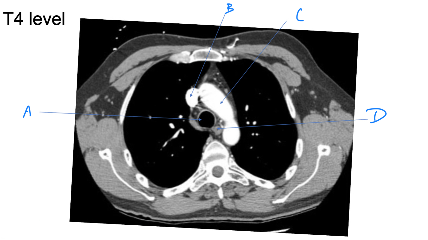 <p>A. Identify</p>