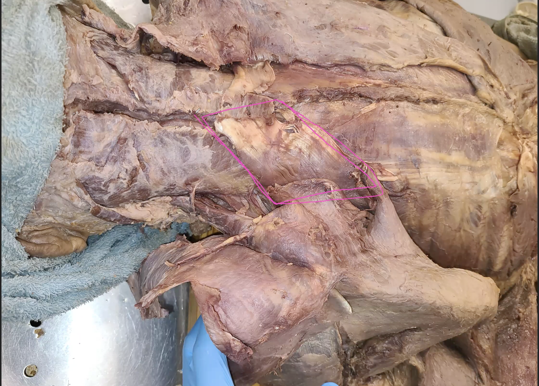 <p>what is circled in pink, directly under rhomboids (shiny tendons)</p>