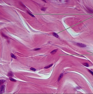 <p><strong>what is the connective tissue?</strong></p>