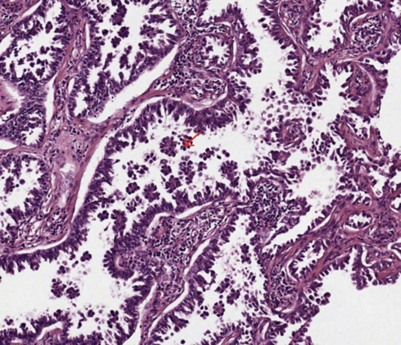 <p>Lung</p>