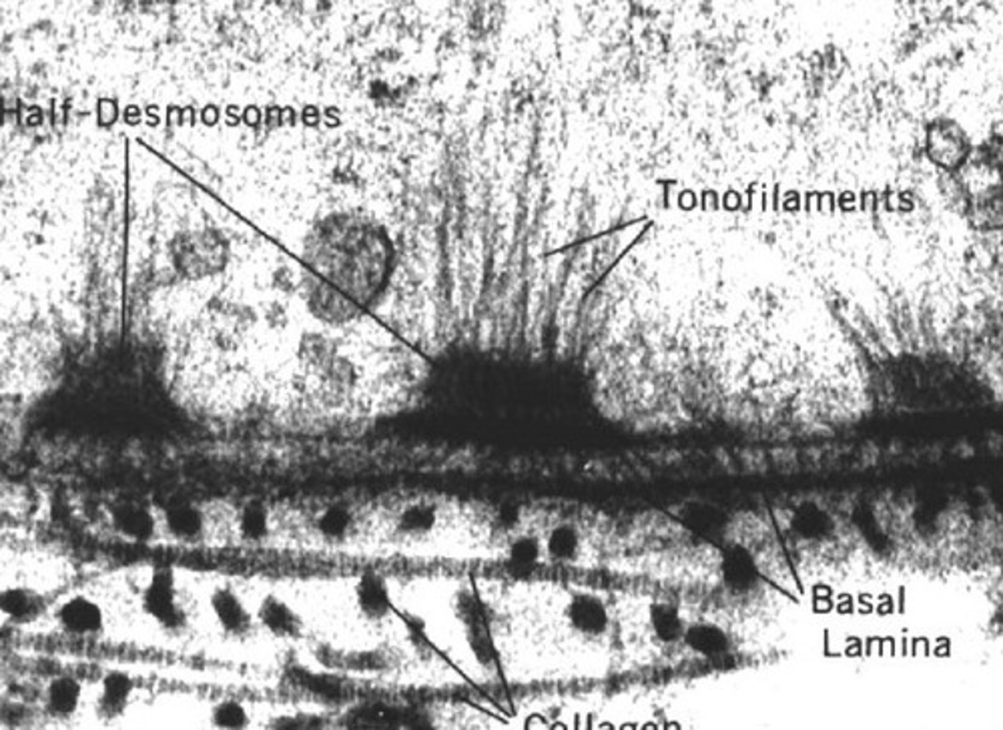 <p>- Anchors intermediate filaments in a cell to basal lamina</p>