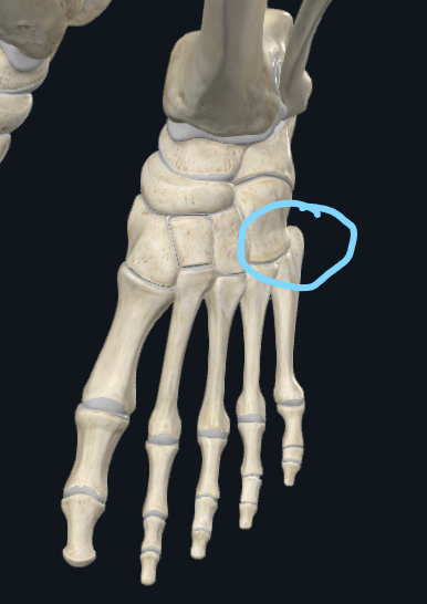 <p>What is this called</p>
