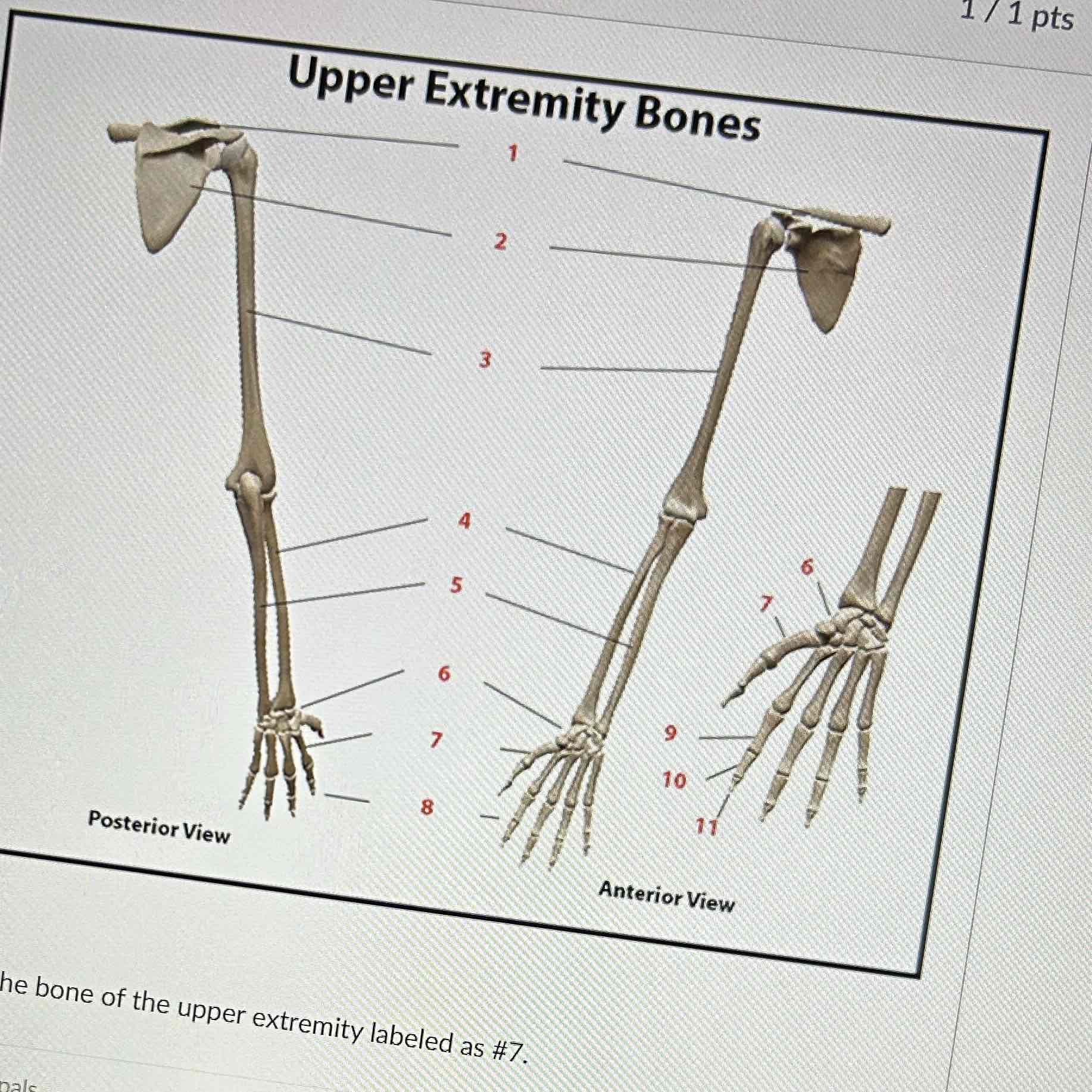 <p>Which upper extremity bone is labeled at #7</p>