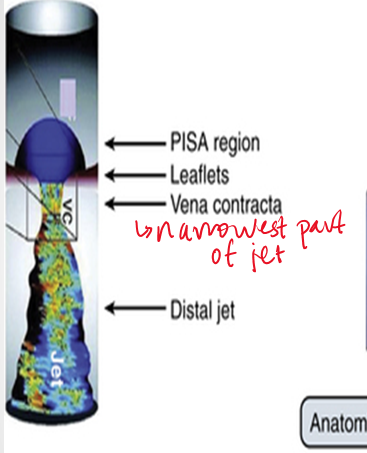 <ol><li><p>4ch view</p></li><li><p>zoom in on MV</p></li><li><p>color doppler</p></li><li><p><strong>lower color scale below 40&nbsp;</strong></p></li><li><p>measure PISA radius&nbsp;</p></li><li><p>measure max velocity of regurg jet using CW doppler</p></li></ol><p></p>