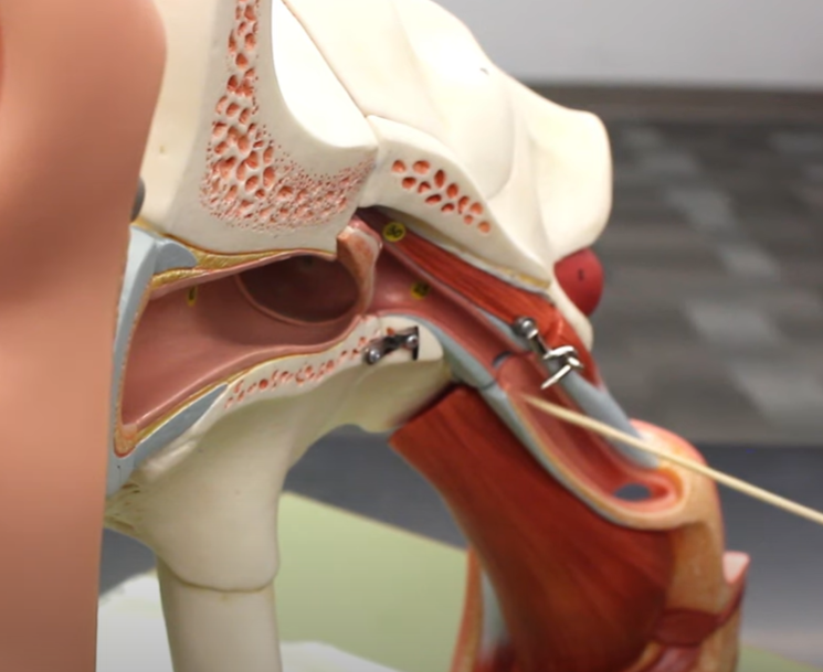 <p>true or false: this is the pharyngotympanic tube</p>