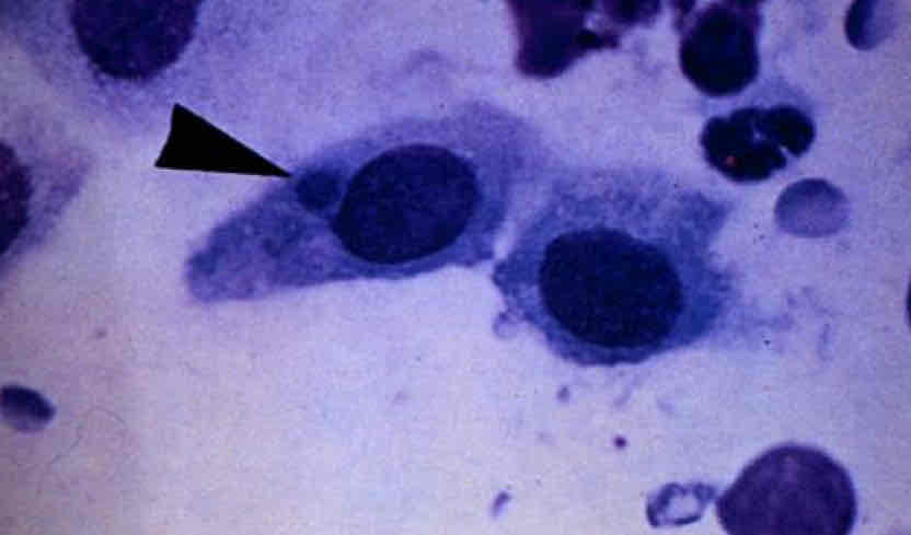 term image