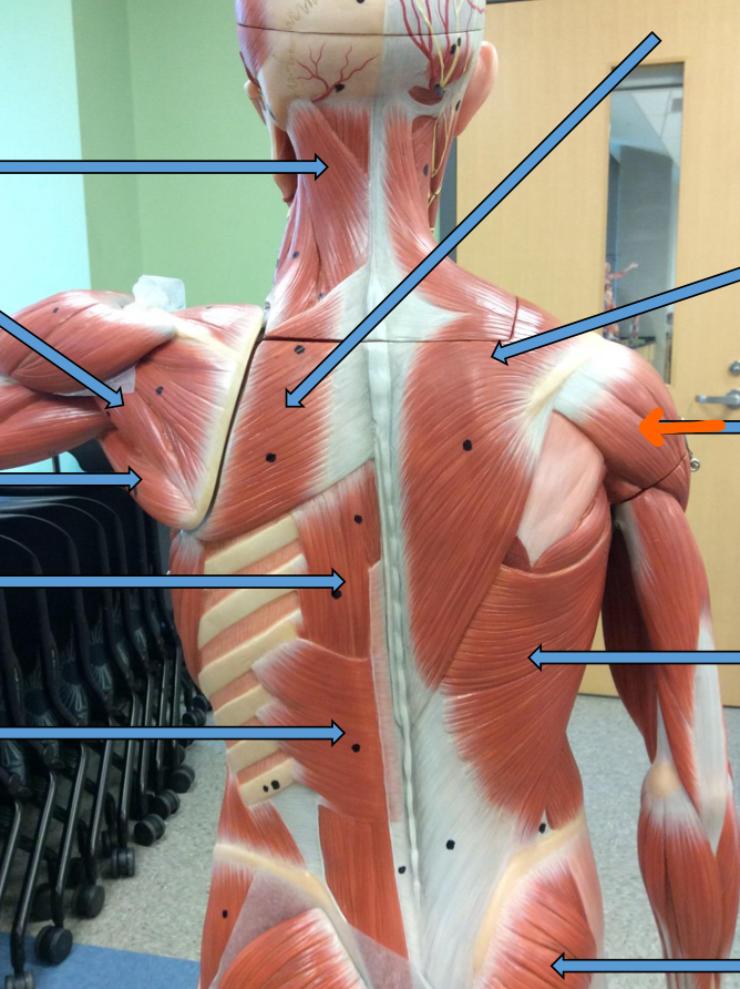 <p>Identify this muscle?</p>