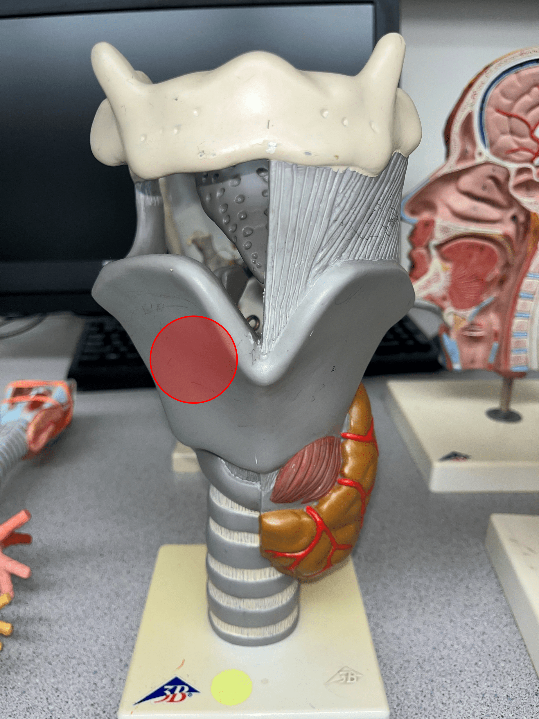 • A single cartilage of the larynx.

• The largest cartilage of the larynx.

• Located on the anterior wall of the larynx. 

• Inferior to the epiglottis and hyoid bon.