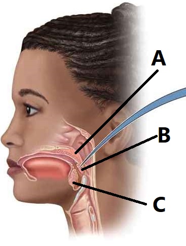 <p>Match each letter in the figure to its correct tonsil.</p><p><br></p>