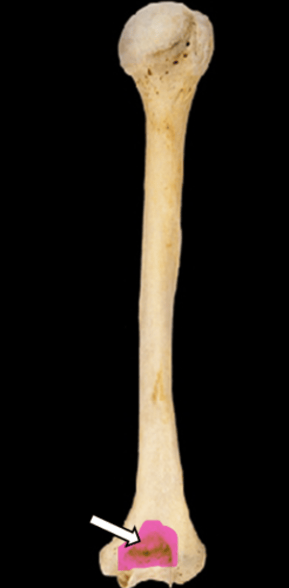 <p>name the part</p>