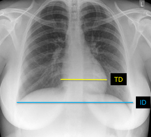 <p>Q what is the name of this measurement? and what is the average + range?</p>