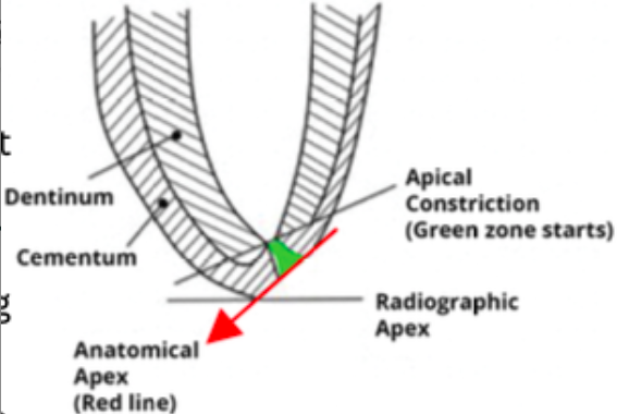 <p><span>a more reliable reference point l</span><span><span>ocating the apical constriction and apical foramen since it is difficult clinically</span></span></p>