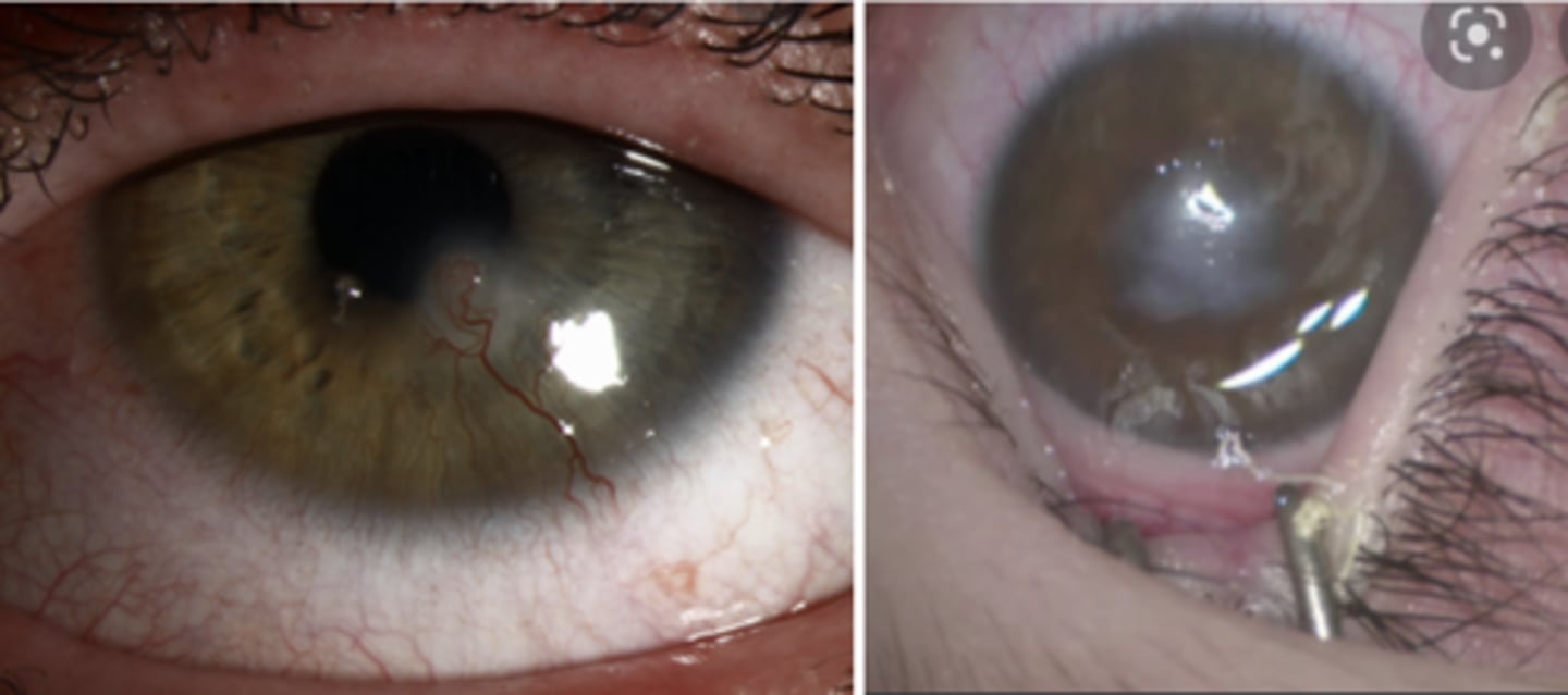 DCC Exam 2 Slides Flashcards Knowt