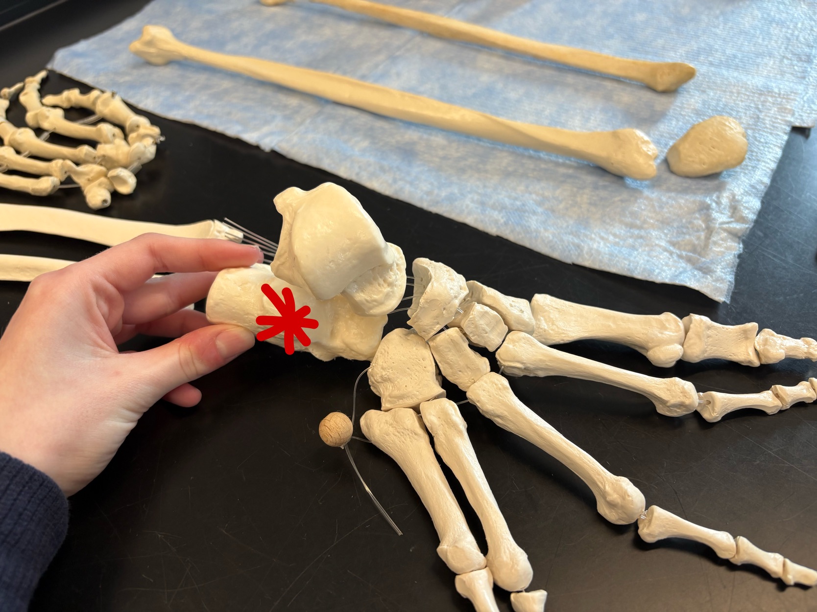 <p>Name this bone</p>