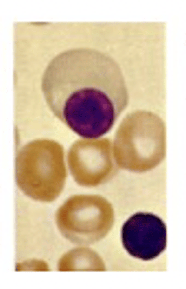 <p>What stage of erythropoiesis is observed?</p>