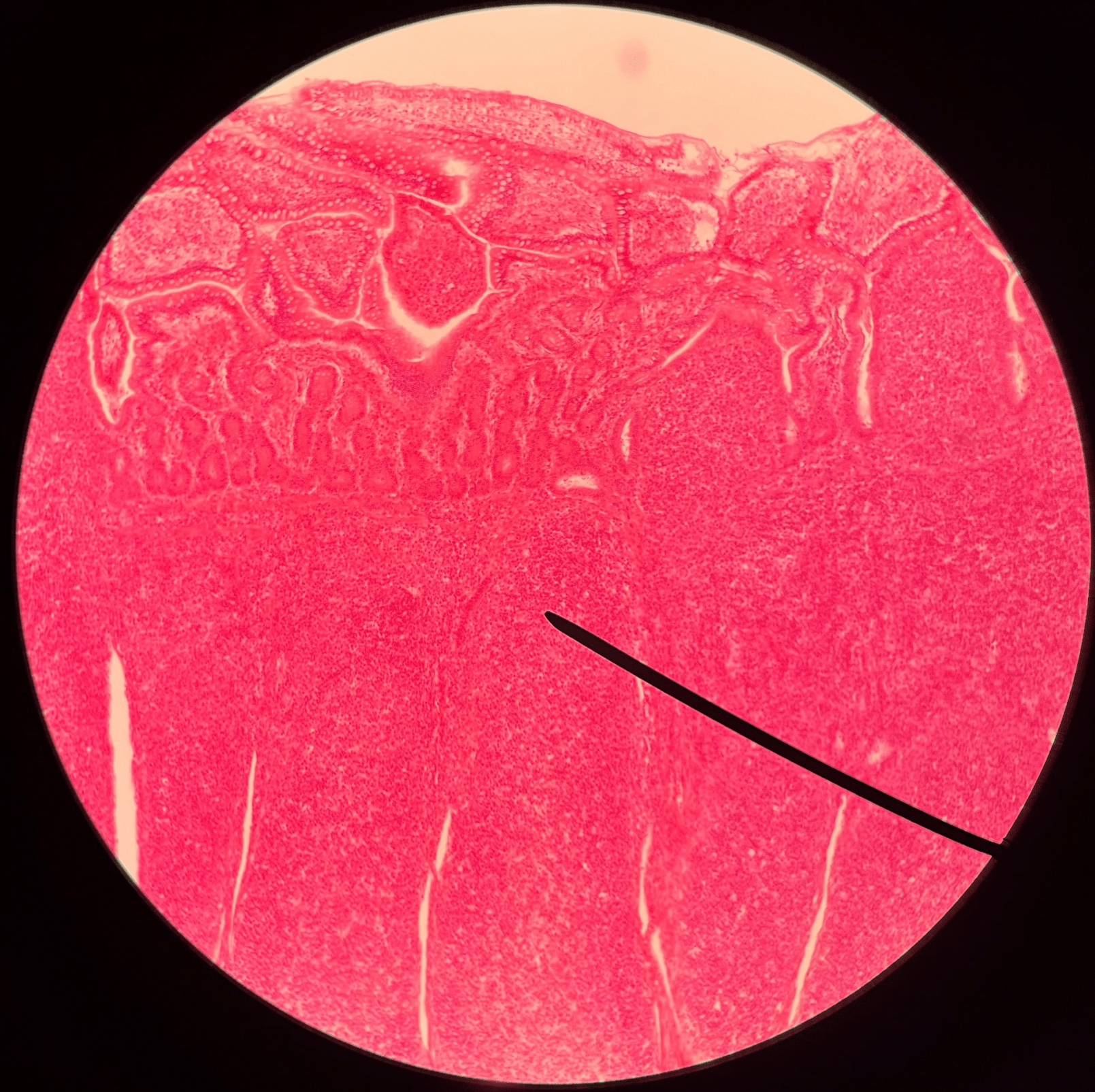• Slide histology of the ileum.

• Located in the submucosa layer of the ileum.

• A round cluster of dark-staining lymphocytes and macrophages.