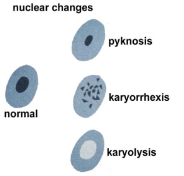 <ul><li><p>zblednięcie i zmniejszenie zasadochłonności jądra</p></li><li><p>zagęszczenie chromatyny (pyknosis)</p></li><li><p>fragmentacja jądra (karyorrhexis)</p></li><li><p>rozpuszczenie jądra przez enzymy (karyolysis)</p></li><li><p>rozpad błony komórkowej</p></li><li><p>obkurczenie wraz z cytoplazmą → kwasochłonna bryłka o wyraźnych granicach</p></li></ul>