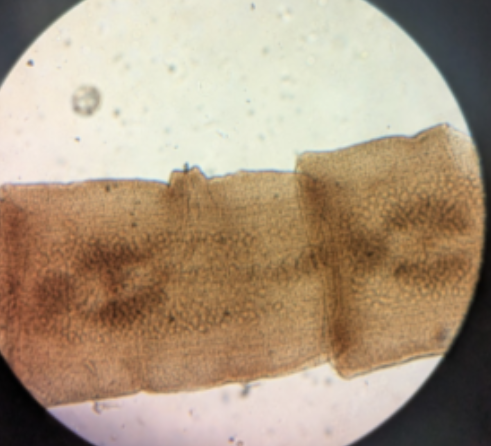 <p>this slide represents phylum platyhelimthes</p>