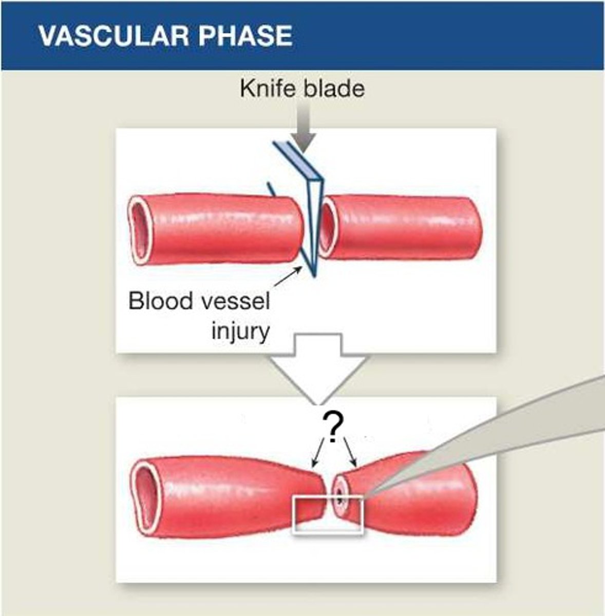 <p>Contraction of the smooth muscle in the wall of a damaged blood vessel to prevent blood loss</p>