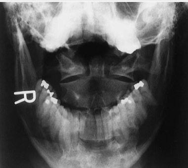 <p>What view is this? What is it great for viewing?</p>