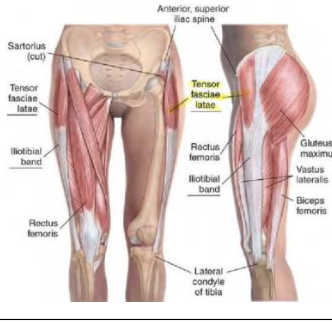<p>TFL - Flexor</p>