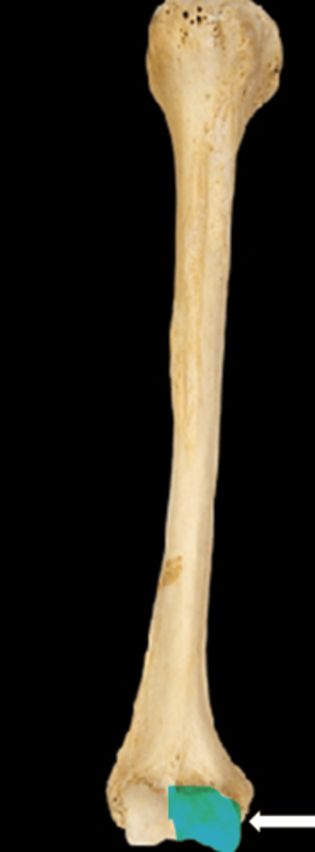 <p>name the part</p>