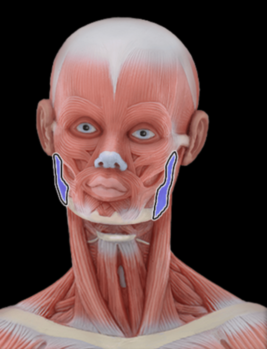 <p>What Muscle Is Highlighted?</p>