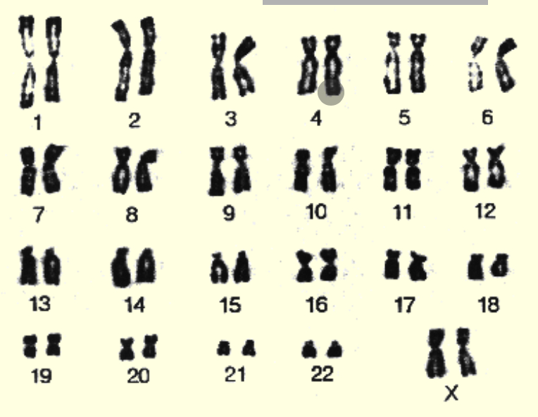 <p>Transparent background realistic ish chromosomes grainy pinched in middle</p>