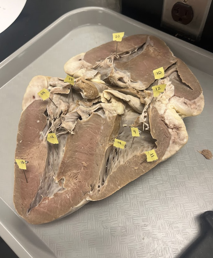 <p>What does number 14 on the heart represent?</p>