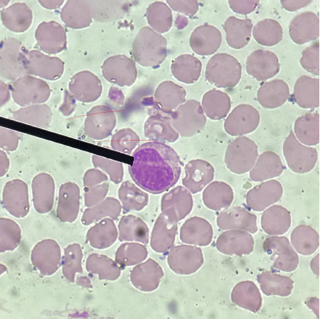 <p>What is the immediate precursor of this cell?</p>
