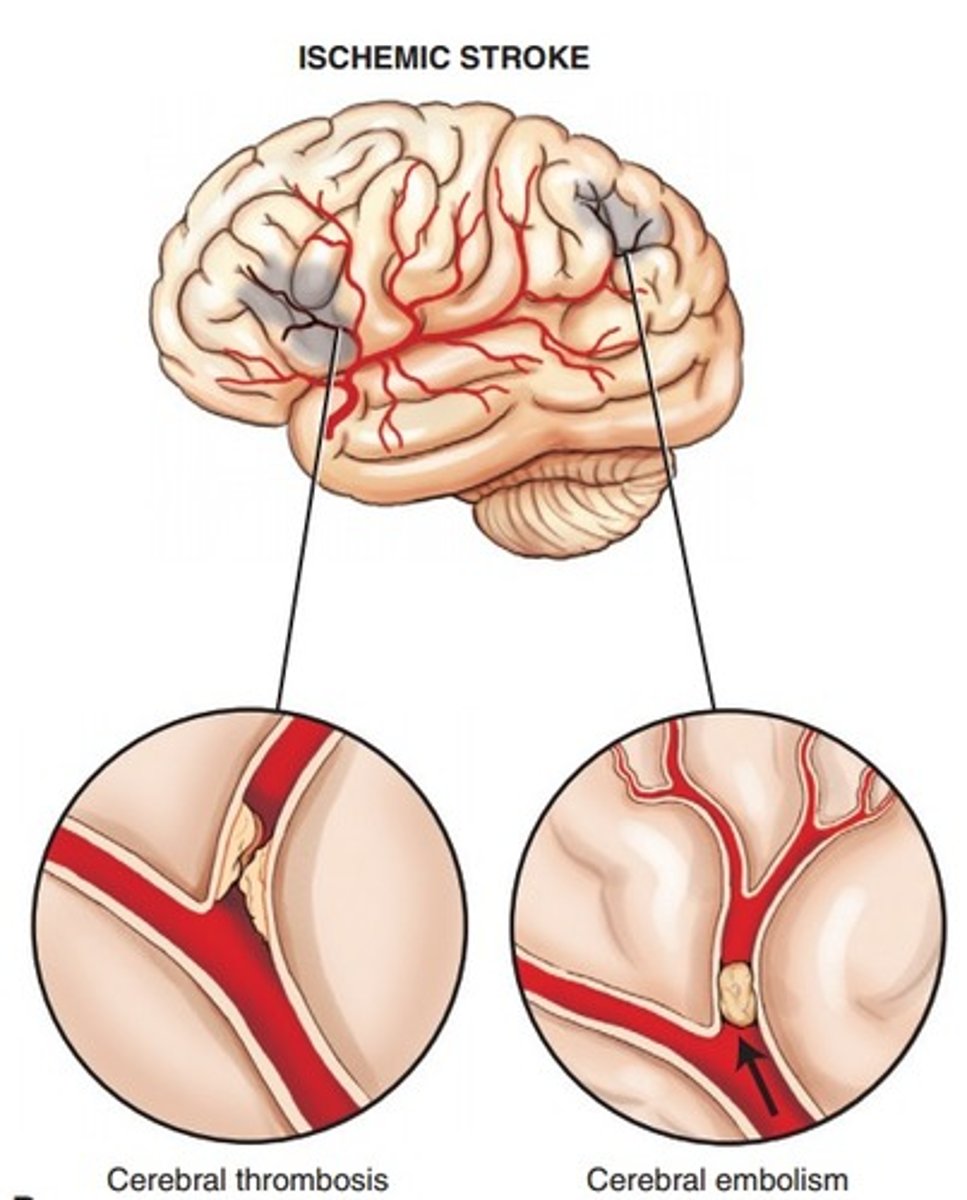 <p>Embolism/thrombosis, high cholesterol.</p>