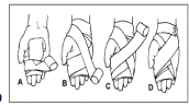 <p>use this  wrap to support or limit joint movemen ankle, or foot </p>