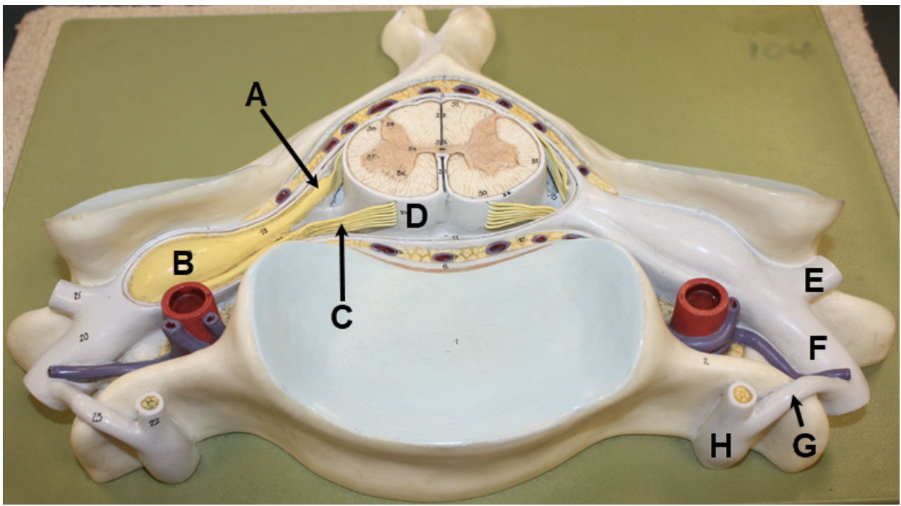<p><span><span>In the image above, identify structures A-C, meningeal layer D, and structures E-H. Question I: the cell bodies of what type of neurons are located in structure B? (Hint for structure G: this model only shows one structure here, but there are actually two.)</span></span></p>