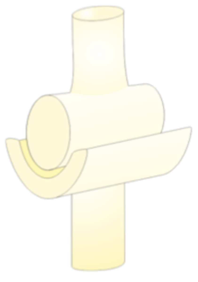 <p>uniaxial; motion in one axis (flexion and extension)</p><p>Ex: interphalangeal joint</p>