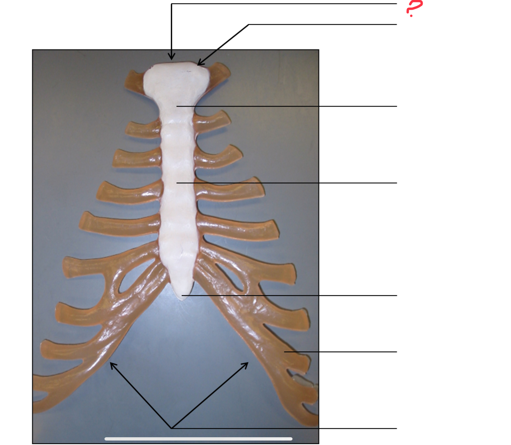<p>jugular notch</p>