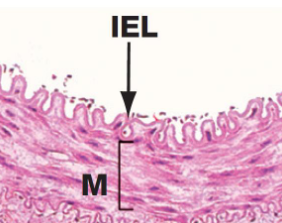 <ul><li><p>Single layer of polygonal, flattened epithelial cells. Elongated in the direction of blood flow</p></li></ul><ul><li><p>Basement membrane</p></li><li><p>Sub-endothelium contains loose connective tissue and fibroblasts</p></li></ul><p></p>