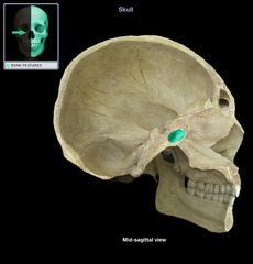 cavity within a bone