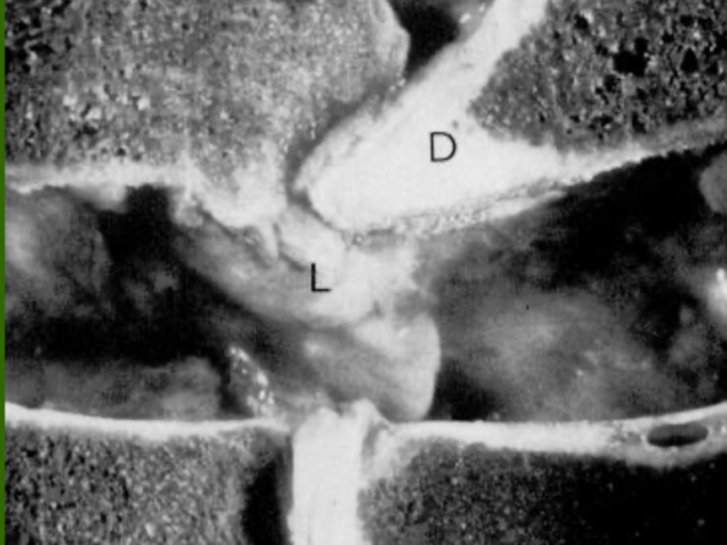 <p>What is the pathology?</p>