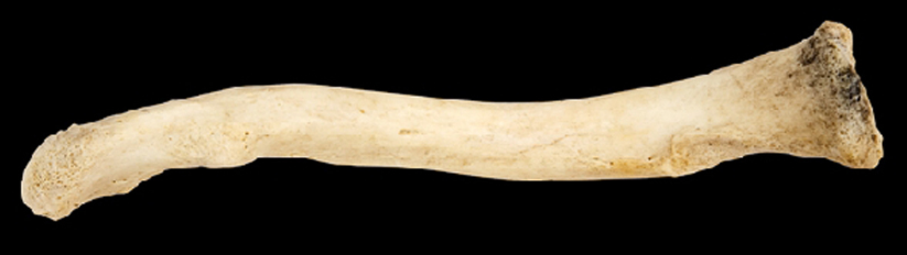 <p>Name this bone.</p><p>Left side or right side?</p><p>(Posterior view).</p>