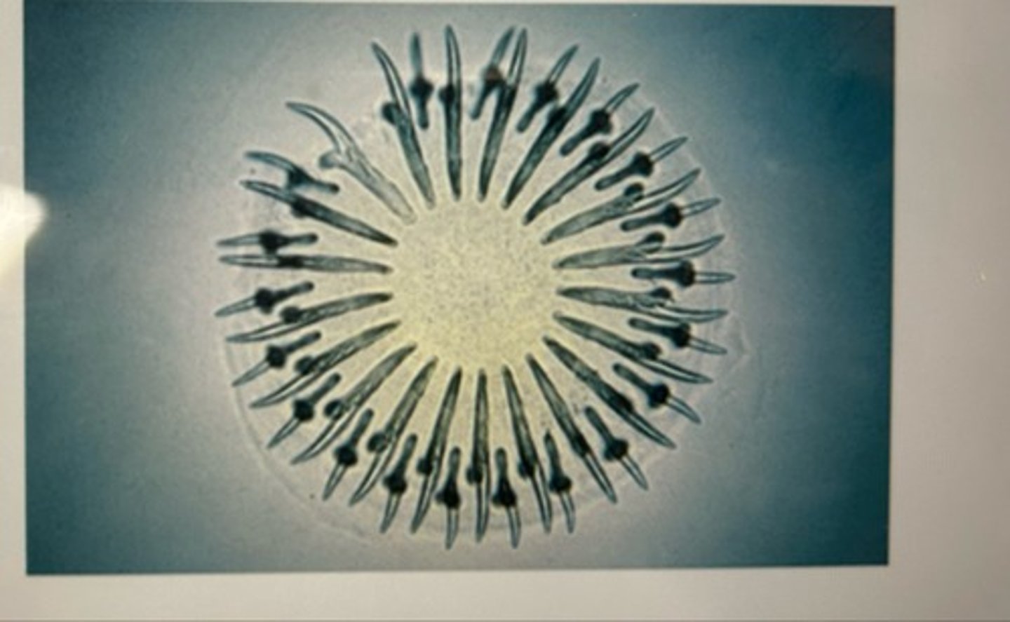 <p>This Cestode has rostellum and acetabula, so it is called a(n) ____ tapeworm</p>