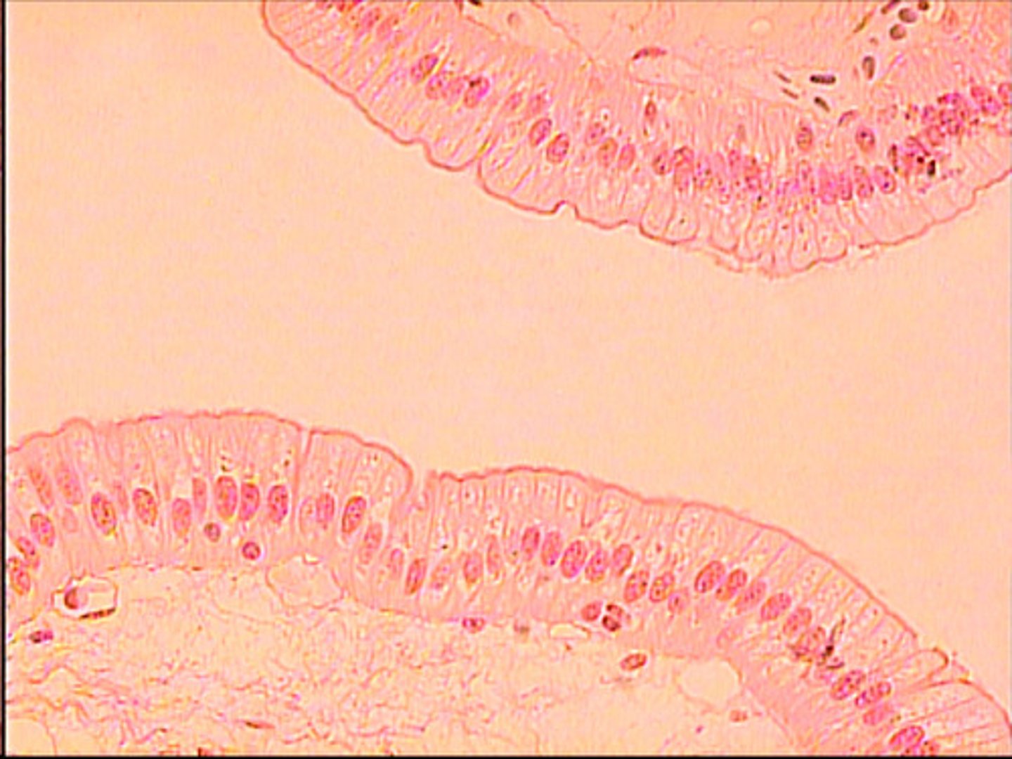 <p>single layer of column shaped cells.</p><p>Nucleaus is near base</p><p>some have cilia</p><p>lines the GI tract, resp. tubes, ovarian tubes</p><p>function: provide protection, secrete and absorb products</p>