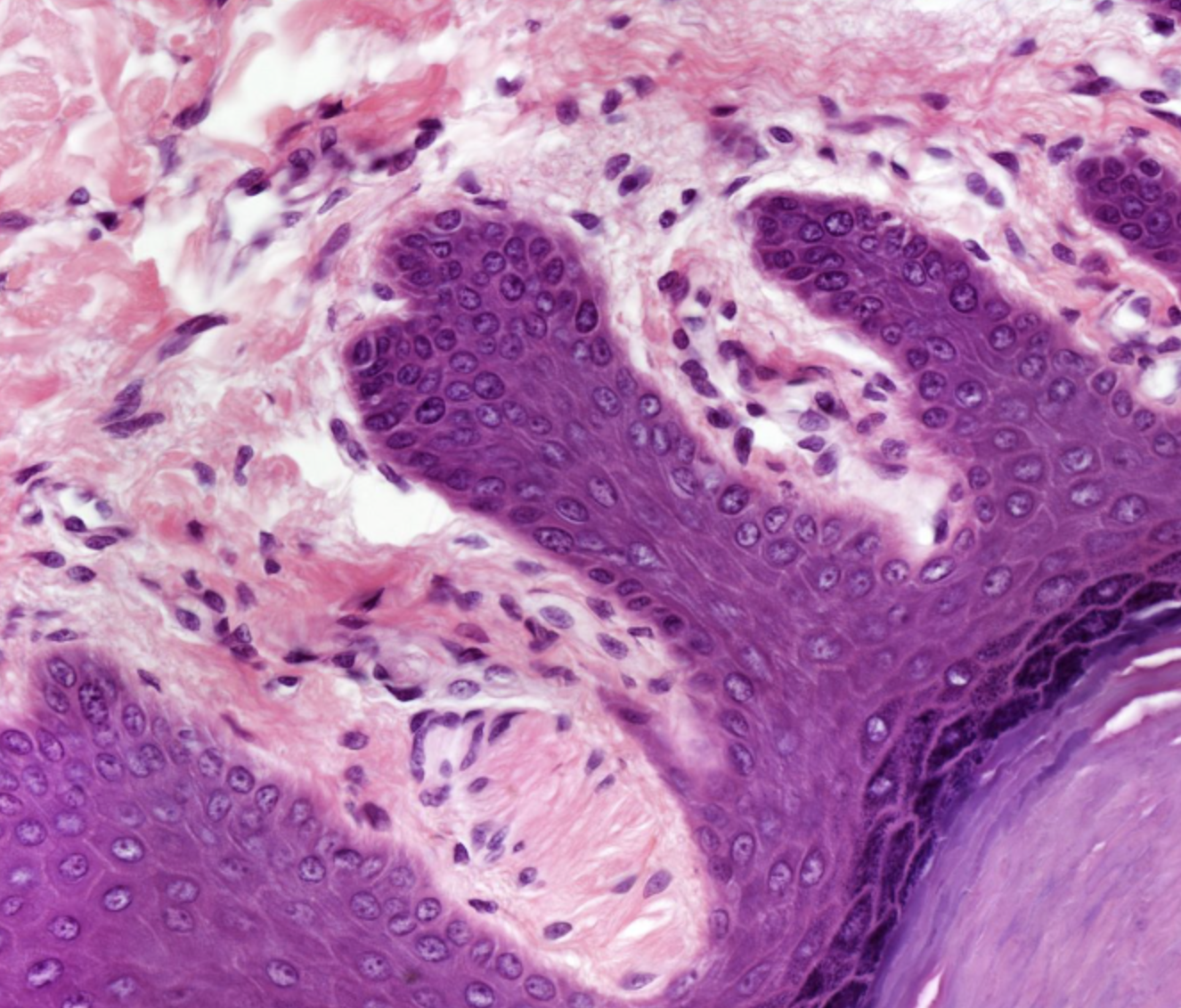 <p>projections of ct into stratified squamous keratinized epithelium</p>