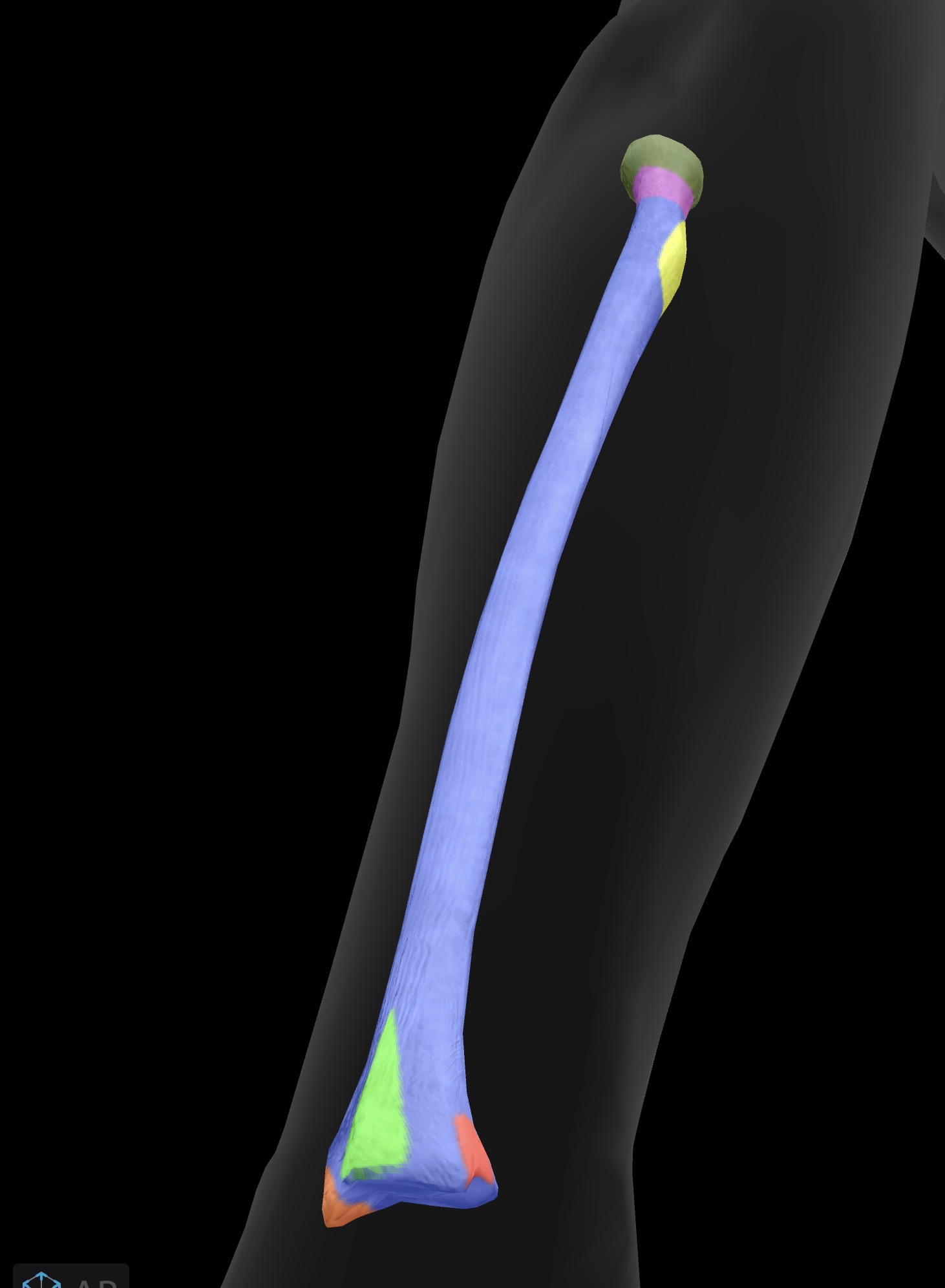 <p>What bone is this? What are the landmarks?</p>