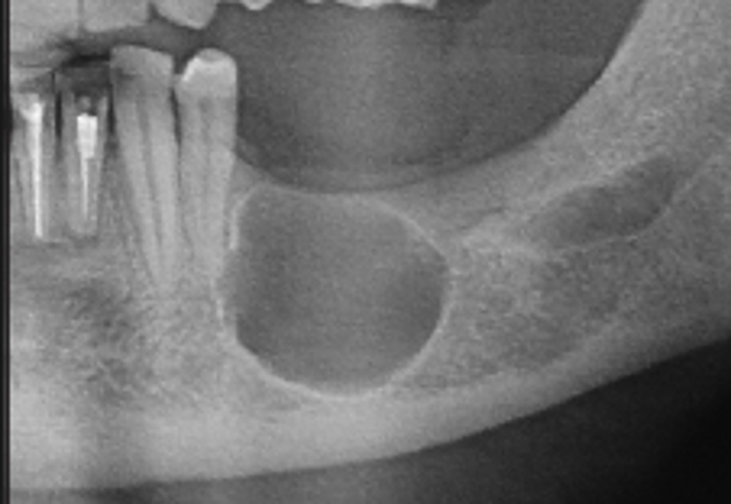 <p>ID the cyst:</p>