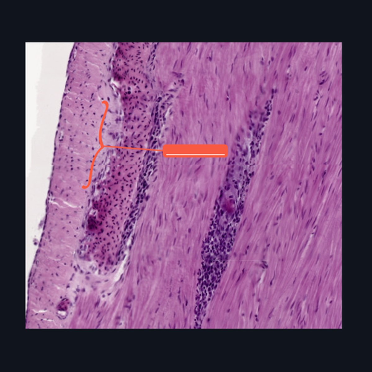 <p>Identify the structure</p>