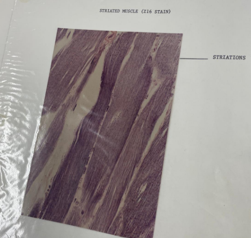 <p>striated muscle tissue </p>