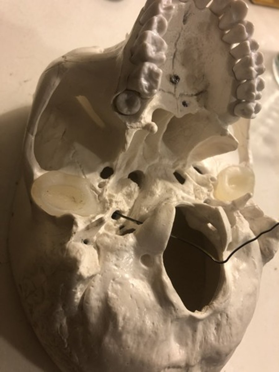 <p>Circular hole; medial to styloid process; stick needle through hypoglossal canal &amp; it will point to this</p>