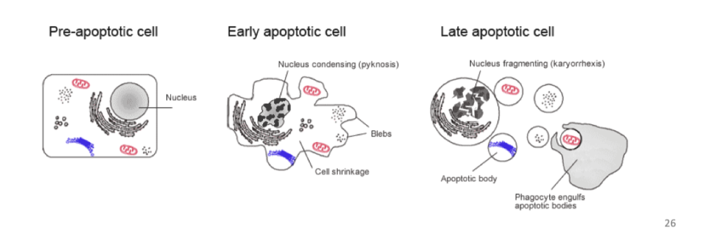 <ul><li><p>A series of biochemical events that lead to characteristic cell changes and cell death / “recycling”. These changes include blebbing,</p></li><li><p>cell shrinkage, nuclear fragmentation, chromatin condensation, and chromosomal DNA fragmentation.</p></li></ul><ul><li><p><span style="background-color: inherit; line-height: 22px; color: windowtext;"><span>Form apoptotic bodies that are then taken up</span></span><span style="line-height: 22px; color: windowtext;"><span>&nbsp;</span></span></p></li></ul><p></p>
