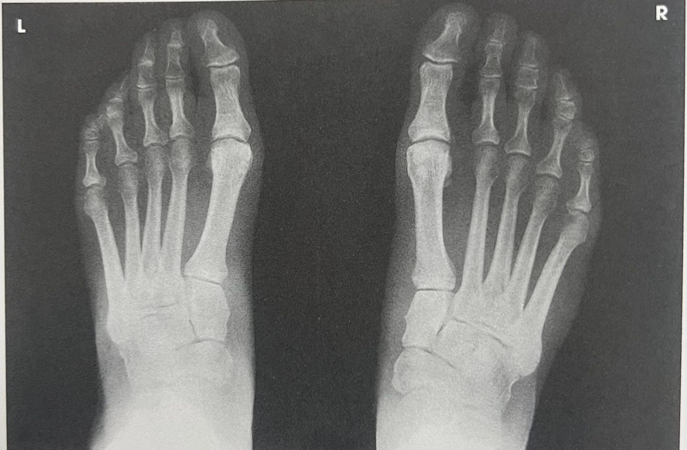 <p>identify the <strong>projection </strong>of the image</p>